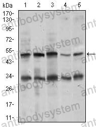 Anti-CHGA Antibody (R3C21)