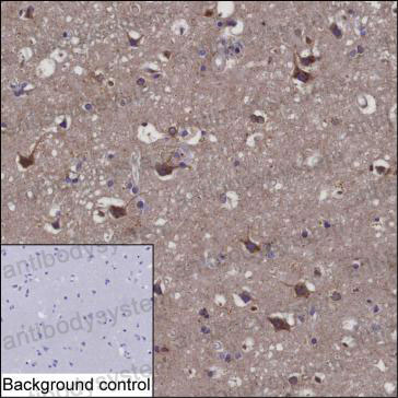 Anti-CLU/Clusterin Antibody (R3C34)
