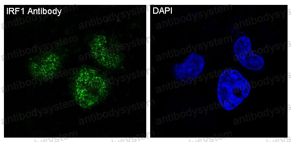 Anti-IRF1 Antibody (R1C26)