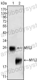 Anti-MYL2 Antibody (R3C35)