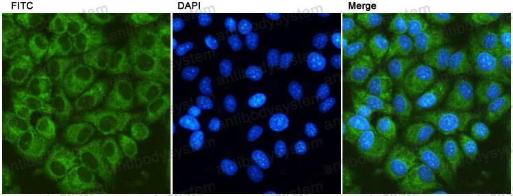 Anti-GRP78/HSPA5 Antibody (R3C37)