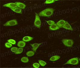 Anti-GRP78/HSPA5 Antibody (R3C39)