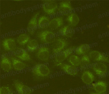 Anti-GRP78/HSPA5 Antibody (R3C40)