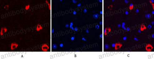 Anti-MAP2 Antibody (R3C43)