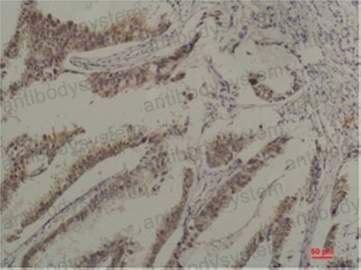 Anti-HSPA8 Antibody (R3C44)