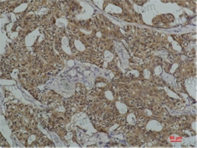 Anti-HSPA8 Antibody (R3C45)