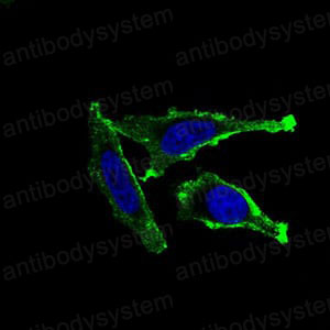 Anti-CD11b/ITGAM Antibody (R3C47)