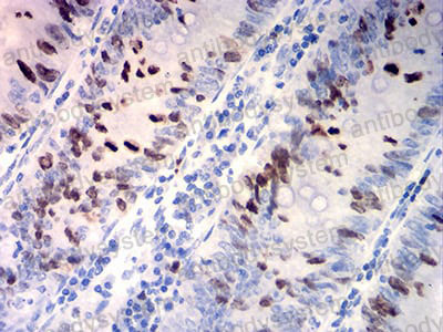 Anti-TOP2A Antibody (R3C60)