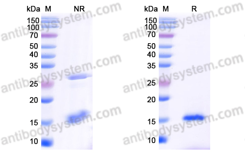 Anti-Human CD20/MS4A1 Nanobody (SAA1332)