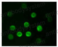 Anti-CD20/MS4A1 Antibody (R3C72)
