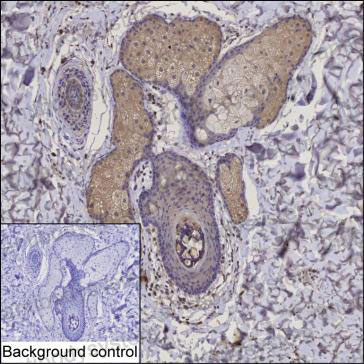 Anti-FGF5 Antibody (R3C77)