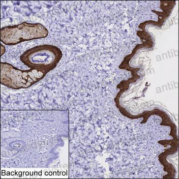 Anti-KRT3 Antibody (R3C79)