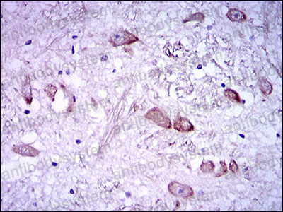 Anti-NEFH Antibody (R3C80)