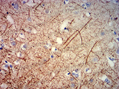 Anti-NEFH Antibody (R3C81)