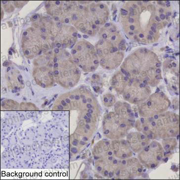 Anti-HARS1 Antibody (R3C83)