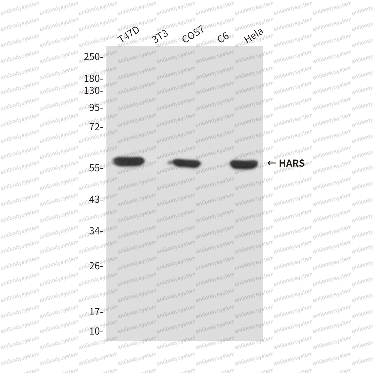 Anti-HARS1 Antibody (R3C84)