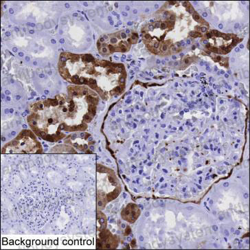 Anti-ANXA3 Antibody (R3C89)