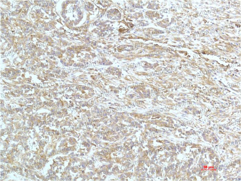 Anti-ACTN1 Antibody (R3C95)