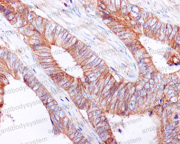 Anti-CD324/CDH1 Antibody (R1A06)