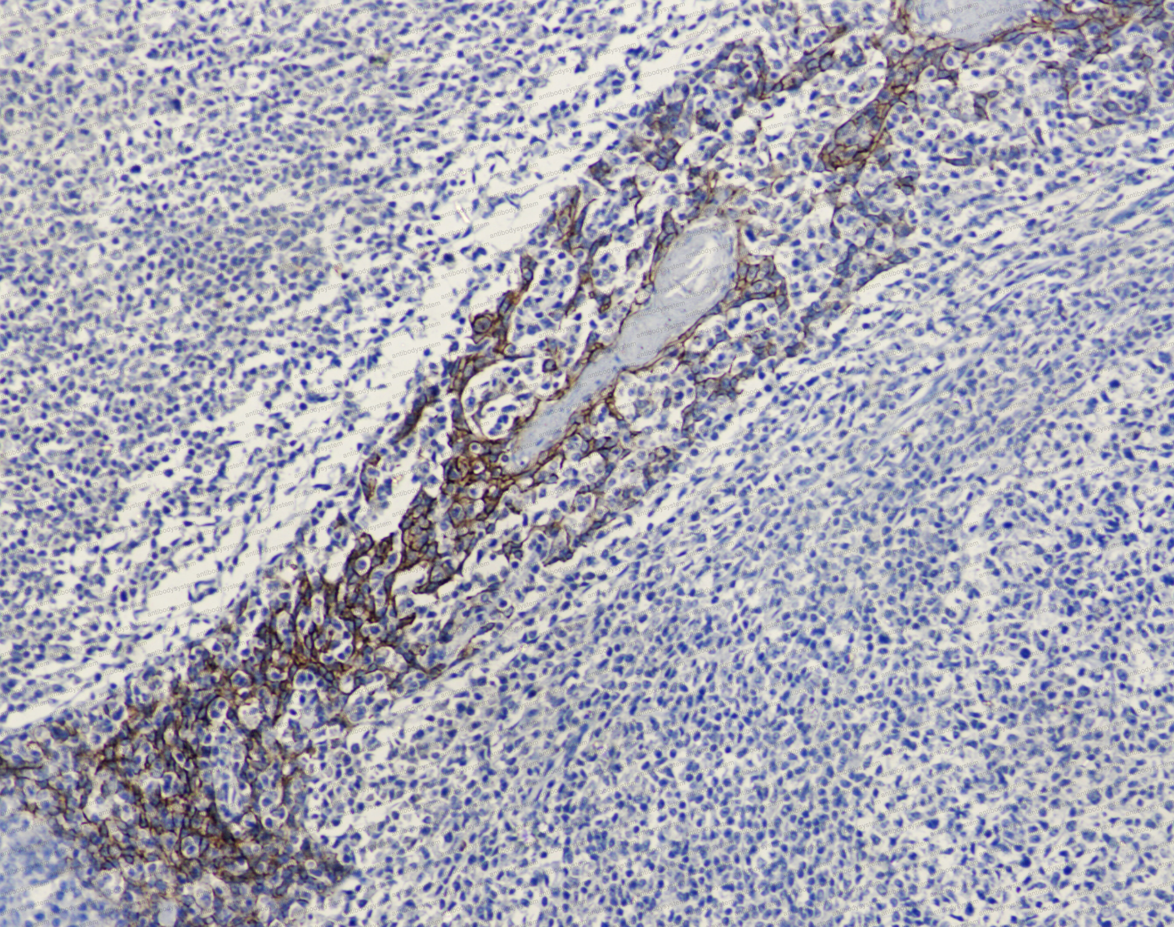 Anti-CD324/CDH1 Antibody (R3D01)