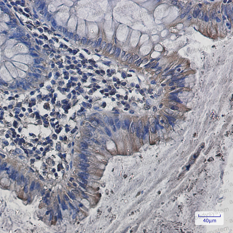 Anti-SRC Antibody (R1N78)