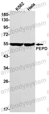 Anti-PEPD Antibody (R1N80)