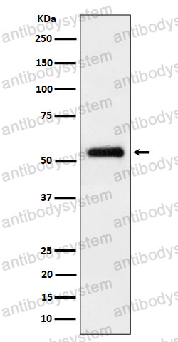 Anti-PEPD Antibody (R1N79)