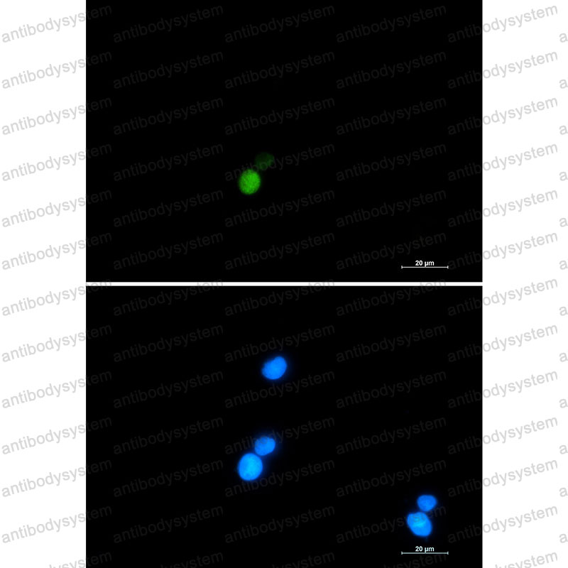 Anti-XRCC6 Antibody (R1N82)