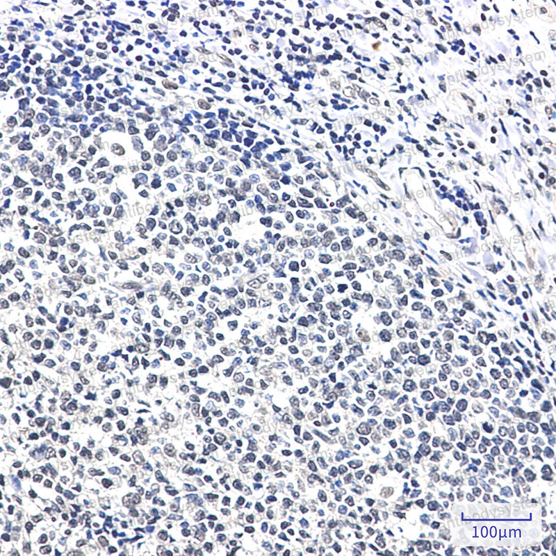 Anti-XRCC6 Antibody (R1N81)