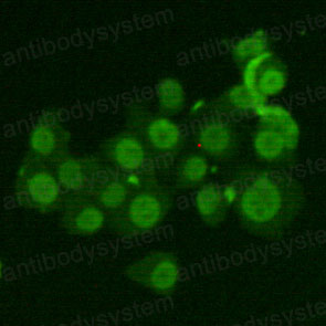 Anti-XRCC6/Ku70 Antibody (R3D08)
