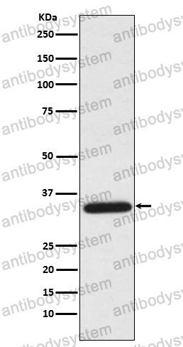 Anti-UNG Antibody (R1N83)
