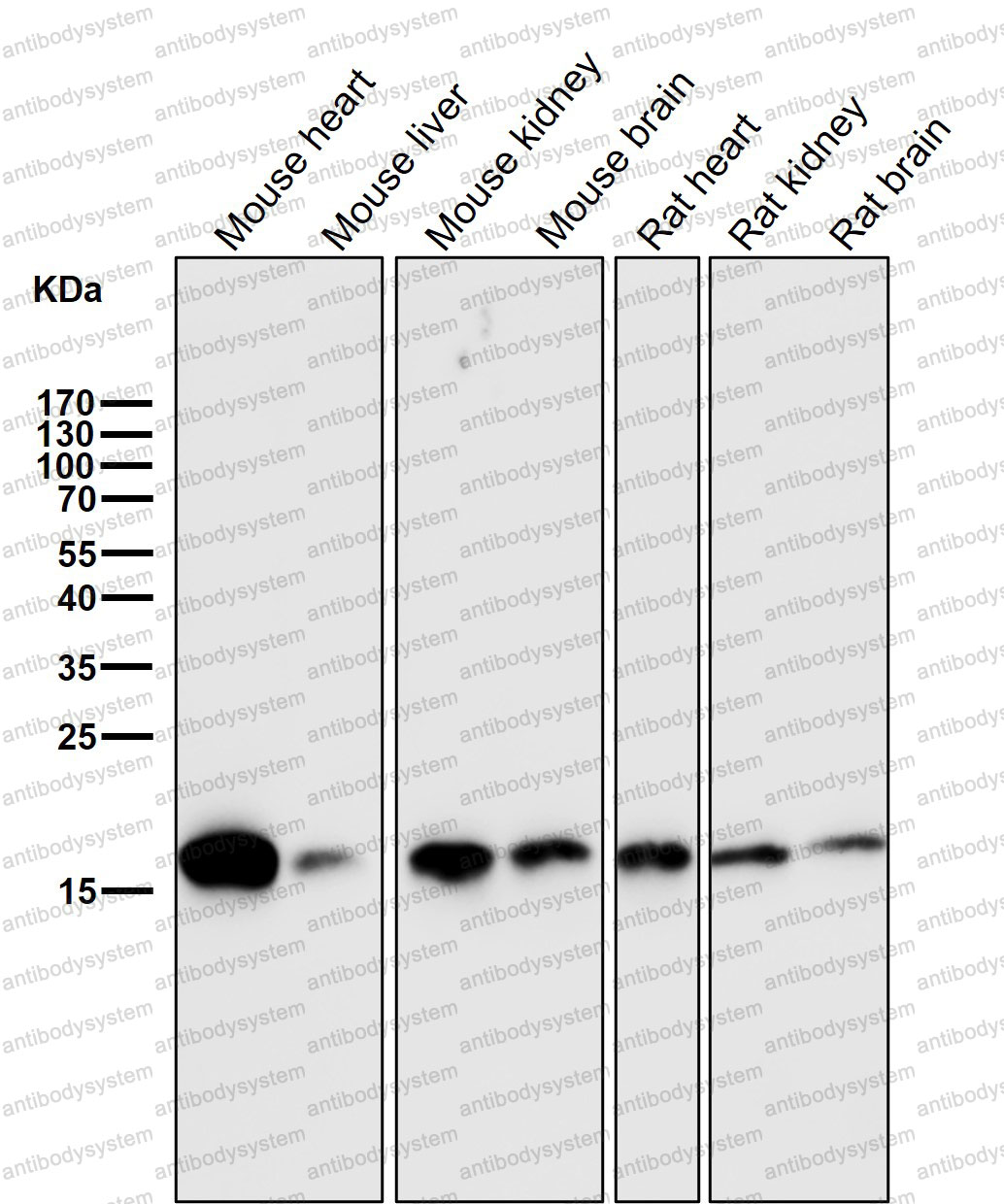 Anti-COX4/COX4I1 Antibody (R1N84)