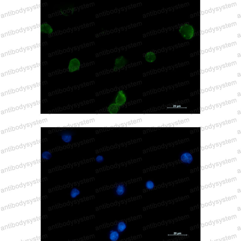Anti-CD225/IFITM1 Antibody (R1N85)