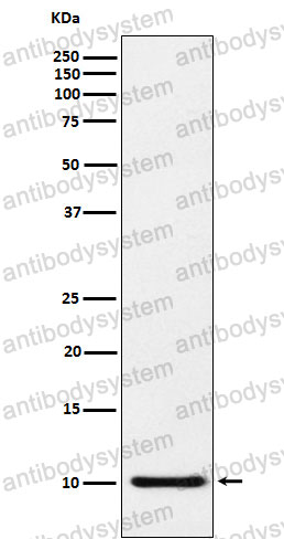 Anti-CCL5/RANTES Antibody (R1N90)