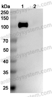 Anti-Human CD56/NCAM1 Antibody (SAA2007)