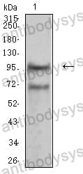 Anti-CD56/NCAM1 Antibody (R3D15)