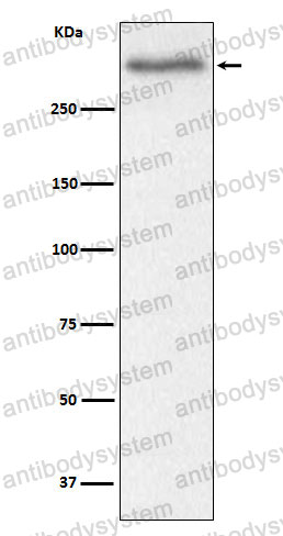 Anti-VCAN Antibody (R1N93)