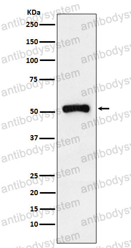 Anti-RARG Antibody (R1N94)