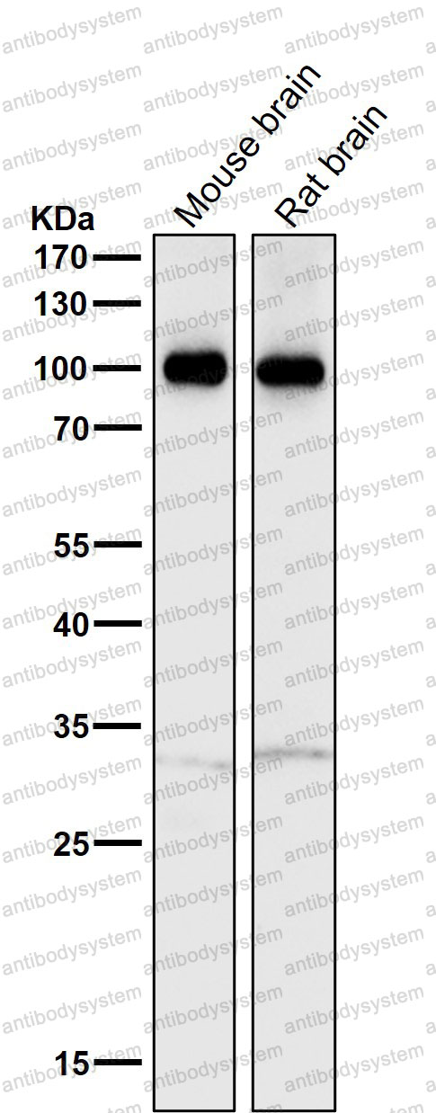 Anti-ATP1A3 Antibody (R1N95)