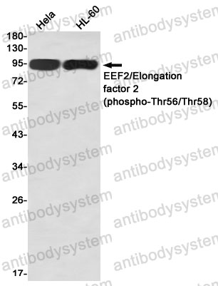 Anti-Phospho-EEF2 (Thr56/Thr58) Antibody (R1N96)