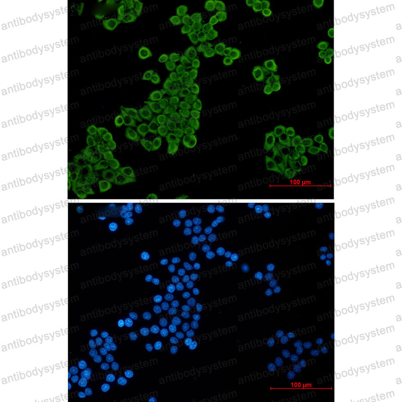 Anti-EEF2 Antibody (R1N97)