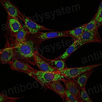 Anti-EEF2 Antibody (R3D23)