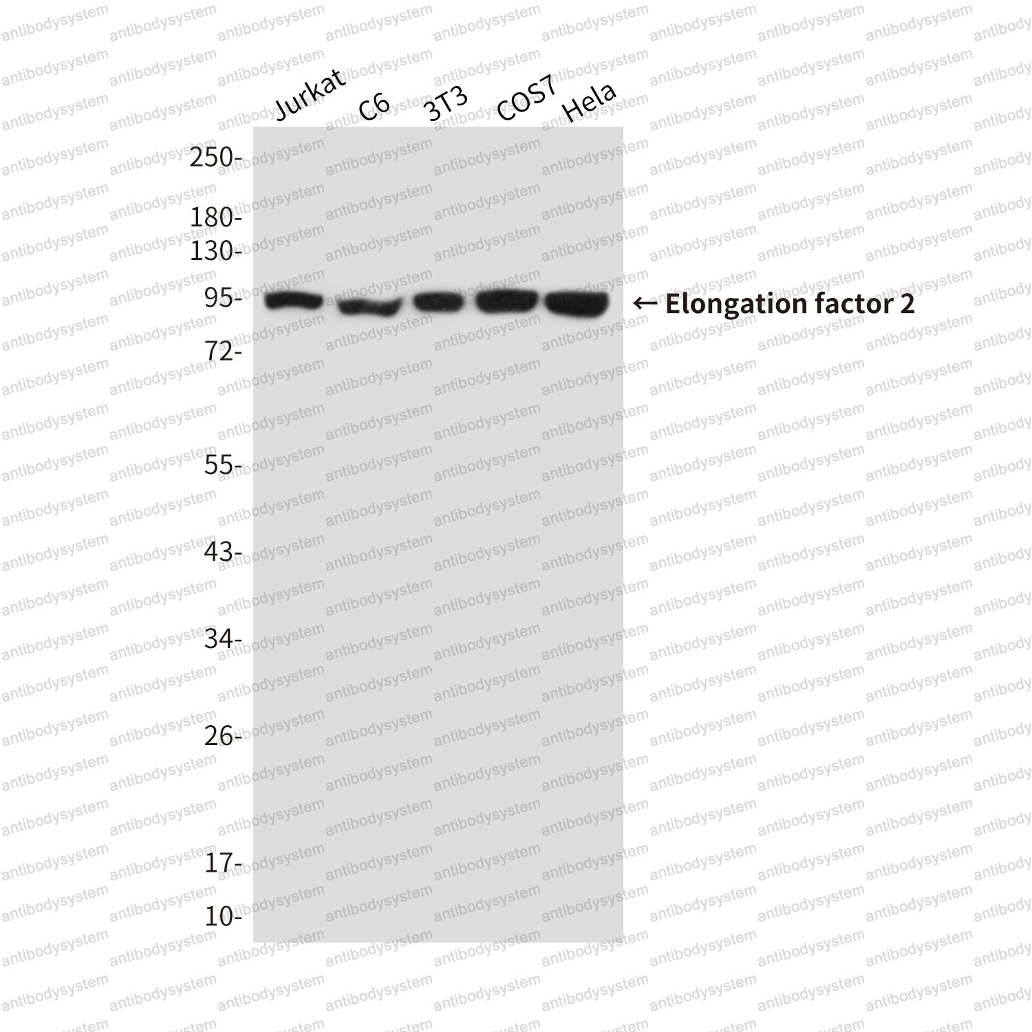 Anti-EEF2 Antibody (R3D24)