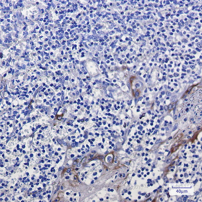 Anti-KRT10 Antibody (R1N98)