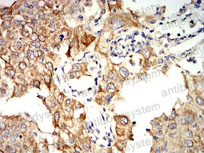 Anti-KRT10 Antibody (R3D26)