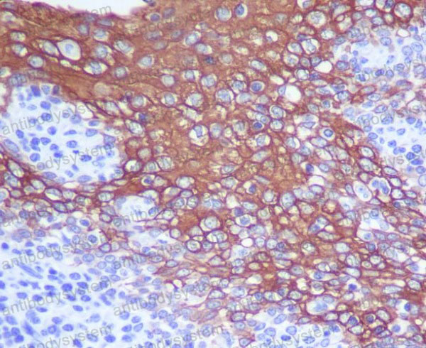 Anti-KRT13 Antibody (R1N99)