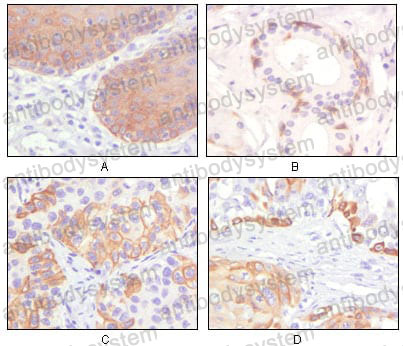 Anti-KRT5 Antibody (R3D32)