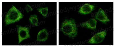 Anti-KRT5 Antibody (R3D33)