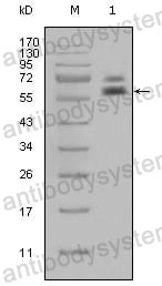 Anti-KRT5 Antibody (R3D34)