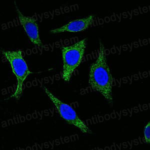 Anti-KRT5 Antibody (R3D35)